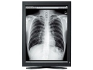 Radiforce GS320(医療用)
